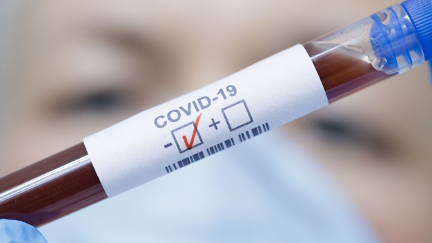 Для плановой госпитализации омичей обяжут сдавать тест на COVID-19