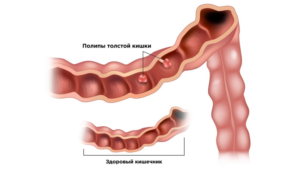 Источник: мсз.рф